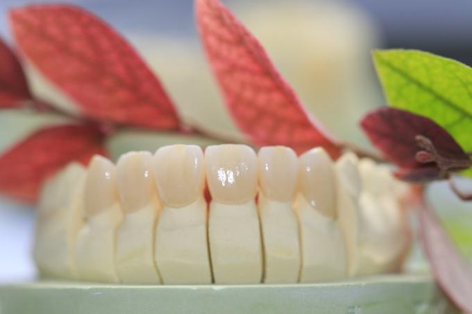 Zirconium Oxide Porcelain Zirconia Dental Crown With Ceramic 1