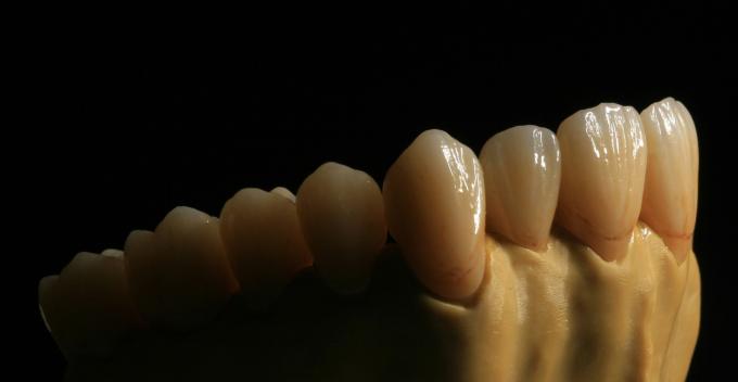 Zirconium Oxide Porcelain Zirconia Dental Crown With Ceramic 0