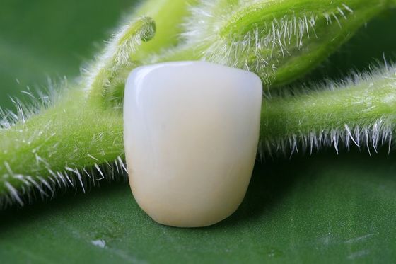 Great Fitness Full Ceramic Biocompatible EMAX Dental Crown