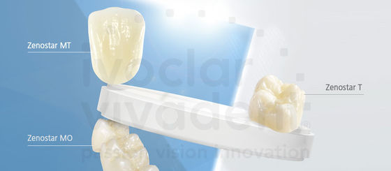 Natural Looking All Porcelain Veneers EMAX Dental Crown