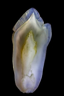 Great Fitness Full Ceramic Biocompatible EMAX Dental Crown