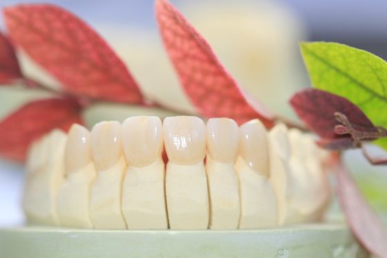 Dental Lab Fixed Prosthetics Layered Zirconia Dental Crown For Front Teeth