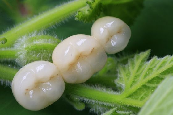 All Ceramic Zirconia Dental Crown