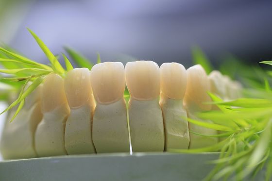 Dental Lab Fixed Prosthetics Layered Zirconia Dental Crown For Front Teeth