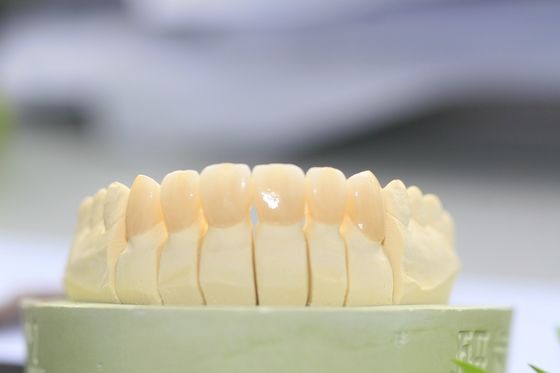 Great Biocompatibility Full Contour Zirconia Dental Crown For Dental Laboratory