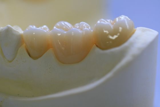 Dental Lab Fixed Prosthetics Layered Zirconia Dental Crown For Front Teeth