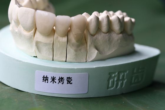 ISO13485 Good Biocompatibility PFM Non Precious Dental Crown