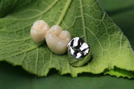 Metal Framework PFM Dental Crown