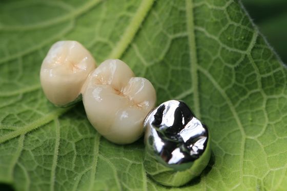 Metal Framework PFM Dental Crown