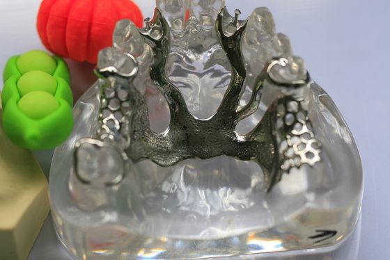 Cr Co Partial Denture Metal Framework