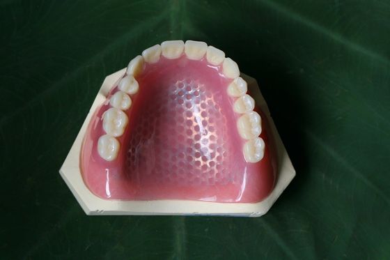ISO13485 Conventional Denture Upper Acrylic Partial