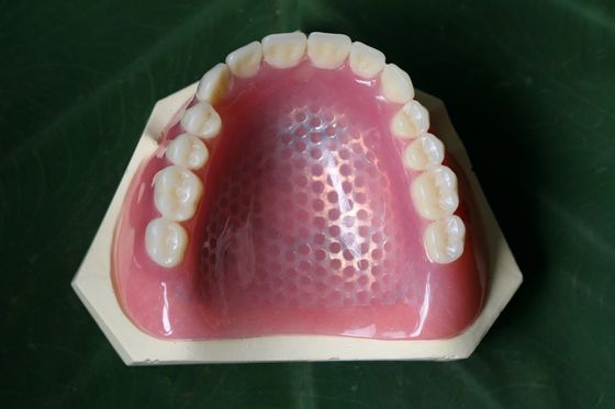 3D Printing Metal Skeleton Partial Denture Metal Framework
