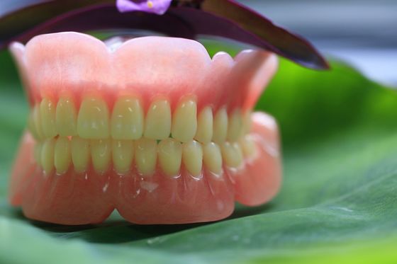 Full Arch Acrylic Partial Denture