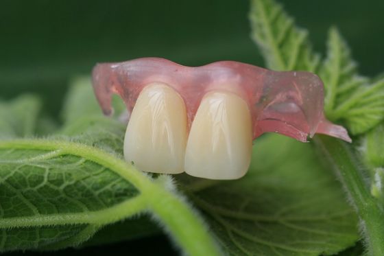 Flexible Invisible Denture