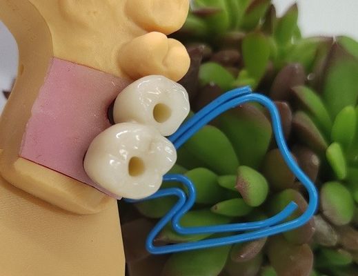 Endosseous Dental Implants Crown
