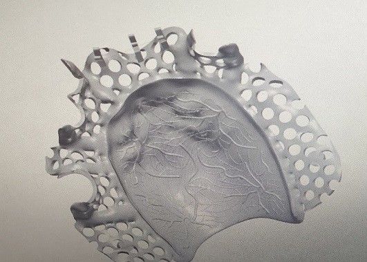 CAD Design Titanium Alloy Partial Denture Metal Framework