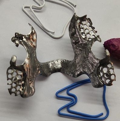 Casted Mandibular Arch Partial Denture Metal Framework