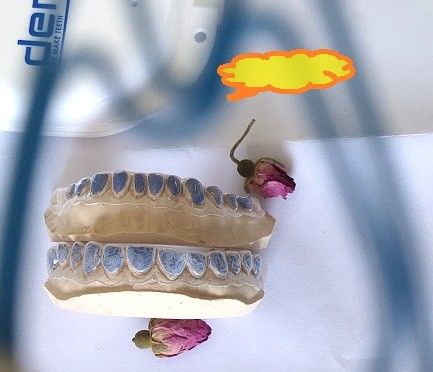 Custom ISO13485 Bleaching Tray For Whitening Teeth