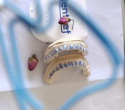 Custom ISO13485 Bleaching Tray For Whitening Teeth