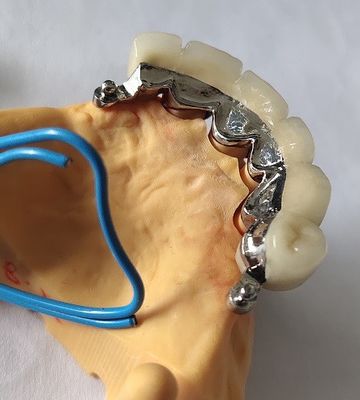 Metal Ceramic Good Fitness PFM Dental Crown
