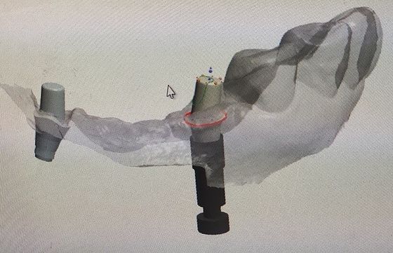 CAD Digital Impression Of Oral Scanning STL Files