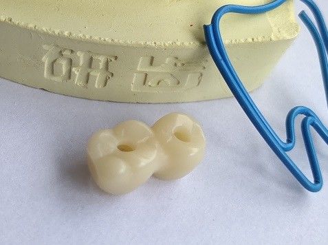 CAD CAM Design Dental 3D Print