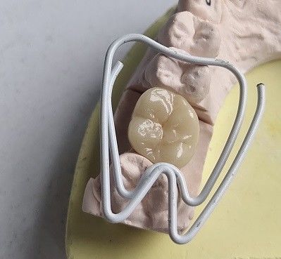 Porcelain Cubic Zirconia Teeth