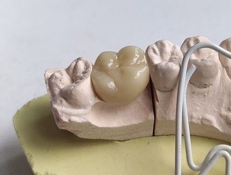 Porcelain Cubic Zirconia Teeth