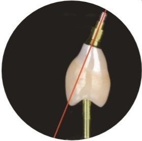Natural ASC Angled Screw Channel Dental Implants Crown