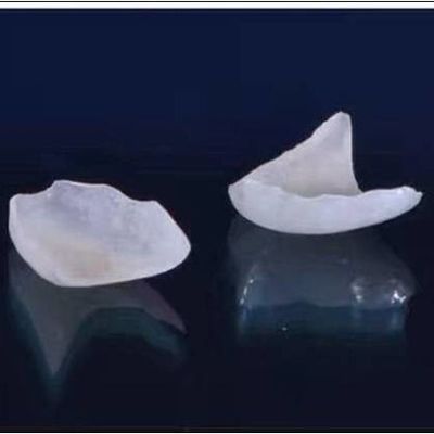 Natural Looking All Porcelain Veneers EMAX Dental Crown