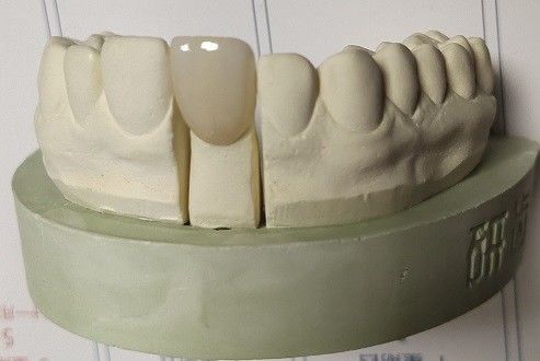 Zirconia Blocks Dental 3D Print By CAD CAM Milling