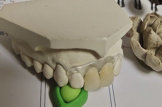 Temporary Soft And Elastic Valplast Invisible Denture
