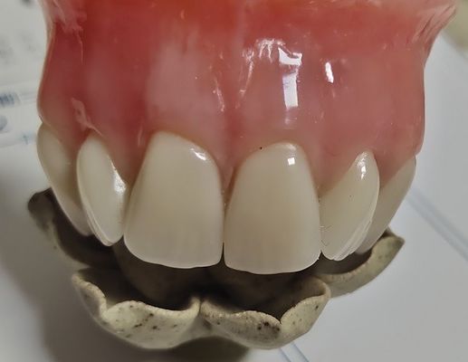 Esthetics Full Denture Cold Cured Acrylic Partial Denture