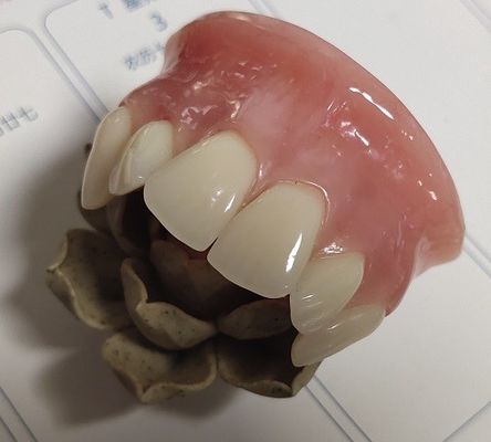 ISO13485 Conventional Denture Upper Acrylic Partial