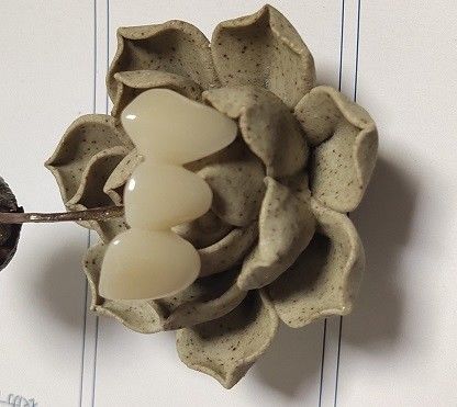 Metal Based Composite Hybrid PMMA Temporary Crown