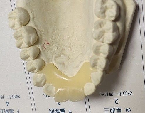 Soft Elastic Nylon Trushine Invisible Denture