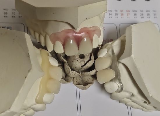 Comfortable Fit ISO13485 RPD Soft Invisible Denture