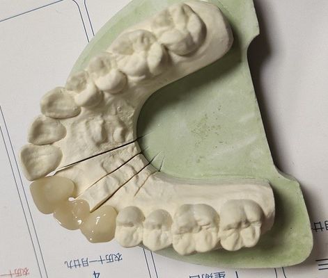 CAD Technique ISO13485 Interim Crown