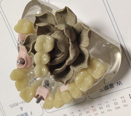 100 Percent Biocompatibility PMMA Provisional Crown
