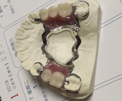 Maxillary Arch Co Cr Alloy Partial Denture Metal Framework