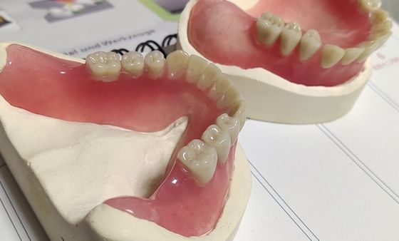 Hot Cured Removable Aesthetic Lower Partial Acrylic Denture