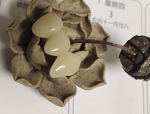 Natural Colour Resin Based Composite Crowns