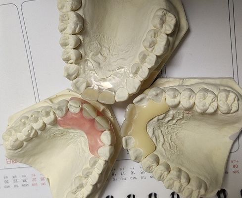 Temporary Soft And Elastic Valplast Invisible Denture