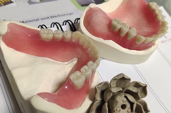 Full Arch Acrylic Partial Denture