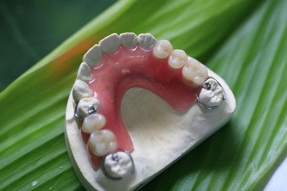 Partial Flexible Invisible Denture For Anterior Teeth