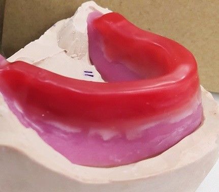 Trushine Dental Record Blocks For Final Full Dentures