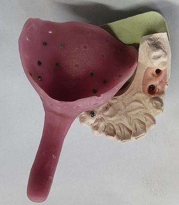 Custom Denture Impression Trays