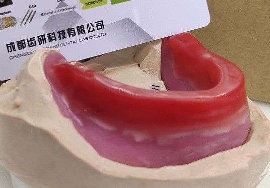 Biteblocks For Jaw Relation Before Complete Denture