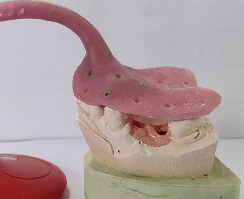 Custom Denture Impression Trays