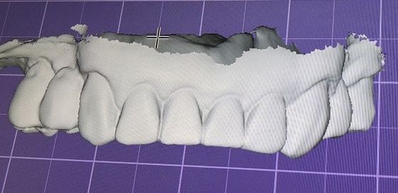 3D Digital Mock Up Teeth Other Dental Products